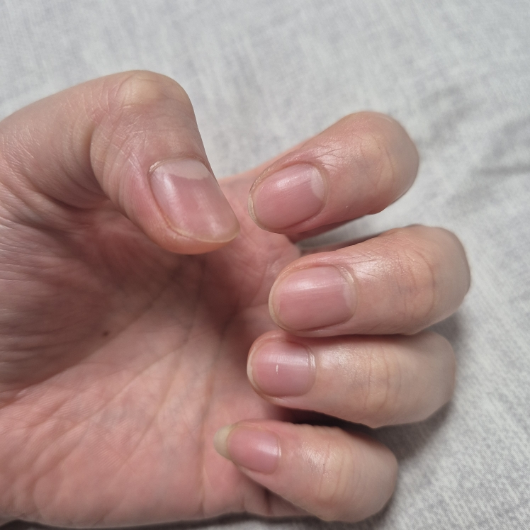 아워덤 (OURDERM) 타임리스뷰티 네일솔루션 review image