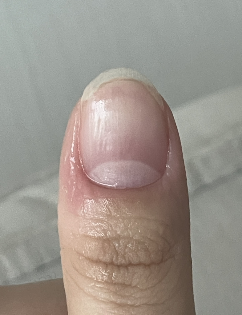 아워덤 (OURDERM) 타임리스뷰티 네일솔루션 review image