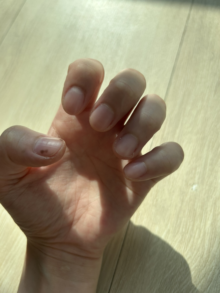 아워덤 (OURDERM) 타임리스뷰티 네일솔루션 review image