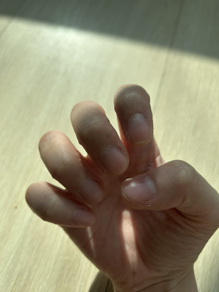 아워덤 (OURDERM) 타임리스뷰티 네일솔루션 review image