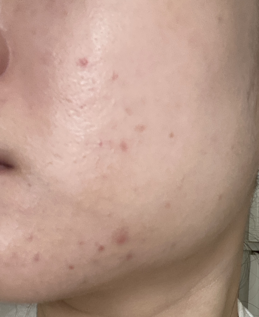 唯拉珠 真正玻尿酸蓝色100安瓿 review image