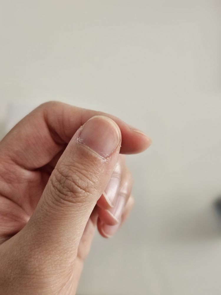 아워덤 (OURDERM) 타임리스뷰티 네일솔루션 review image