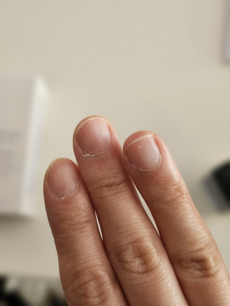 아워덤 (OURDERM) 타임리스뷰티 네일솔루션 review image