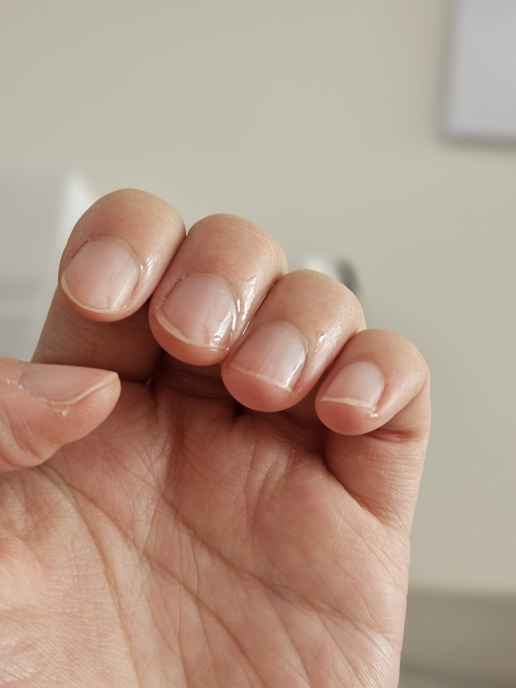 아워덤 (OURDERM) 타임리스뷰티 네일솔루션 review image