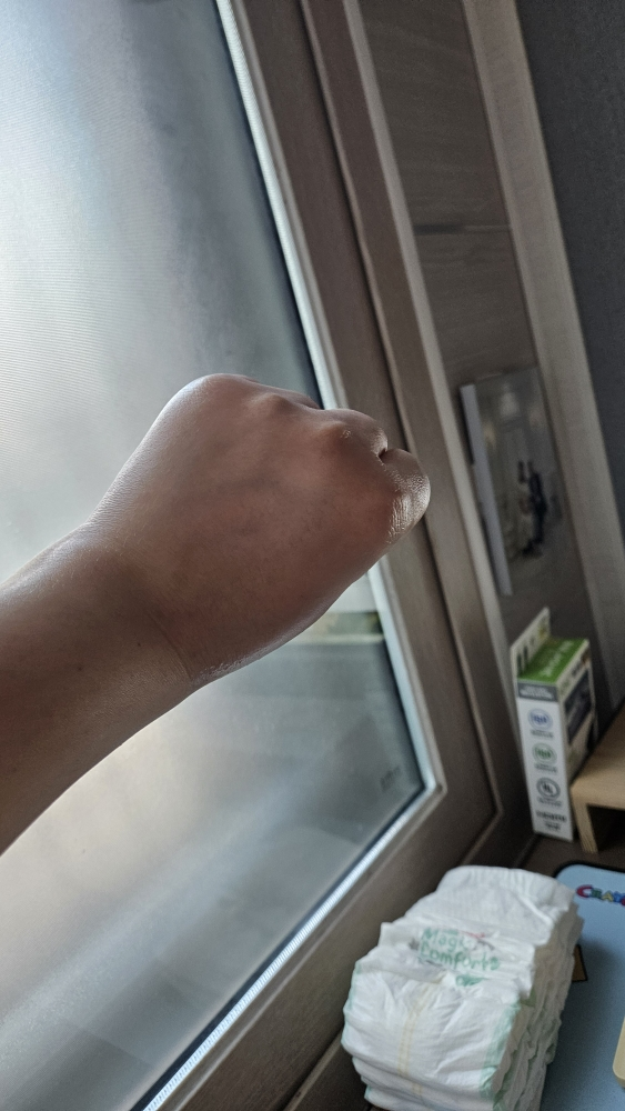 믹순 (mixsoon) 히알레배 포어 버블 세럼 review image