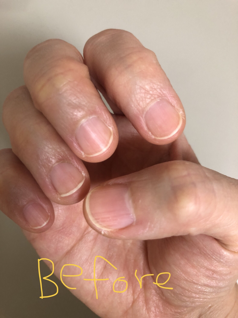 永恒之美的美甲解决方案的真实用户使用照片