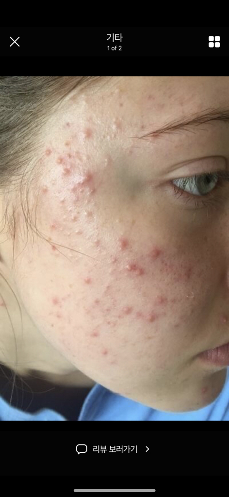 Ảnh đánh giá thực tế của người dùng về Centella Trouble Spot