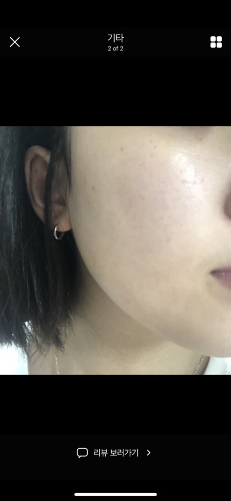 Ảnh đánh giá thực tế của người dùng về Centella Trouble Spot