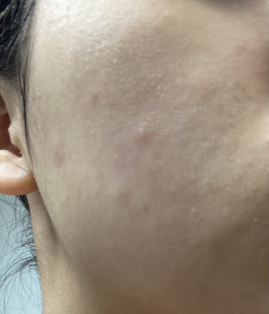 阿彼芙 黄芩草泰卡胶囊精华镇静滴剂 review image