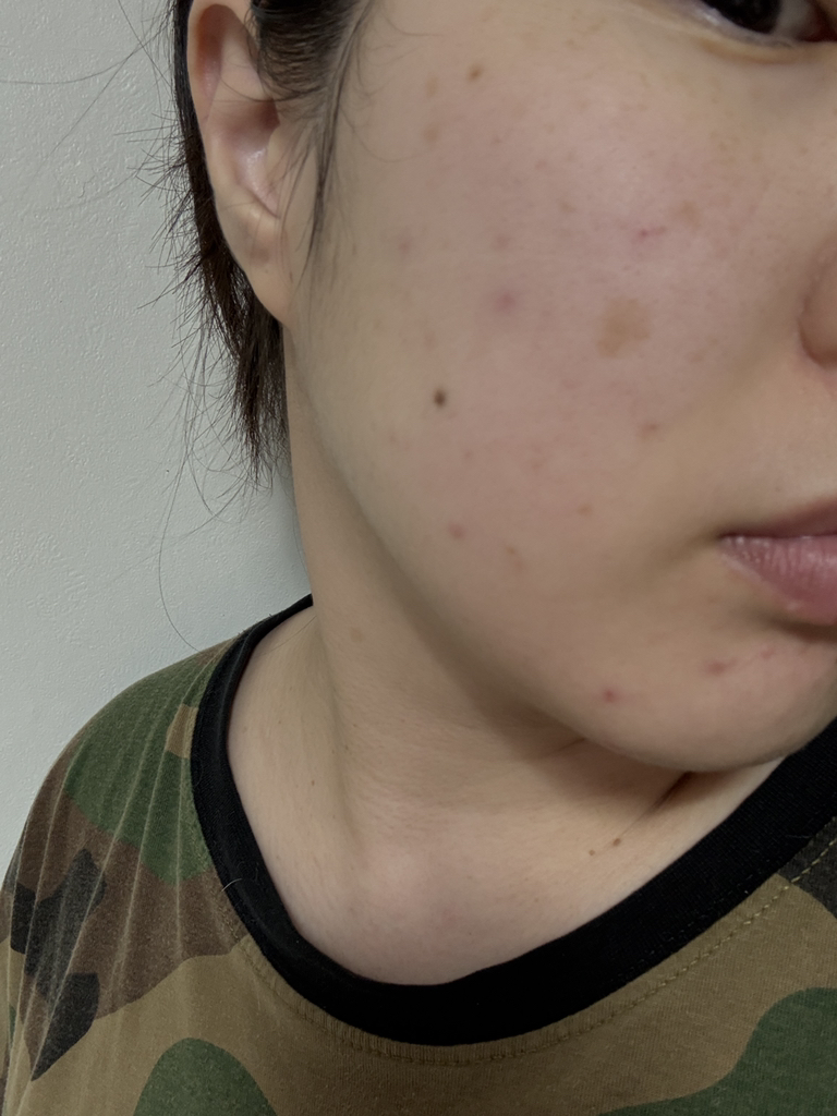 清爽海带深层面膜的真实用户使用照片