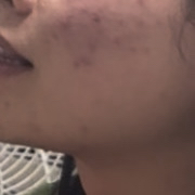 梦幻遮瑕膏的真实用户使用照片