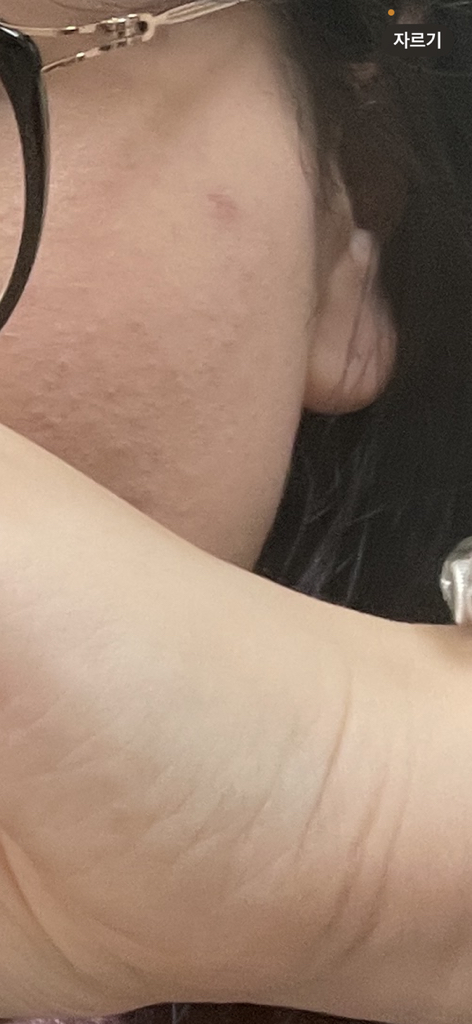 梦幻遮瑕膏的真实用户使用照片