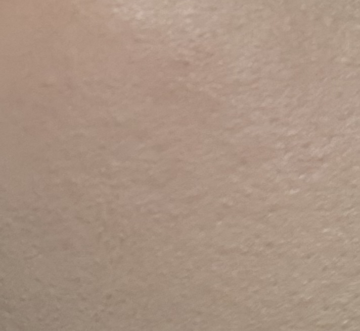 水橙美肤的真实用户使用照片