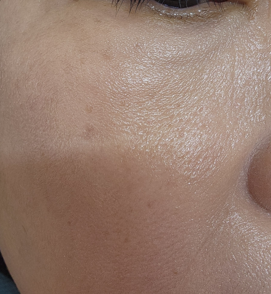 梦幻遮瑕膏的真实用户使用照片