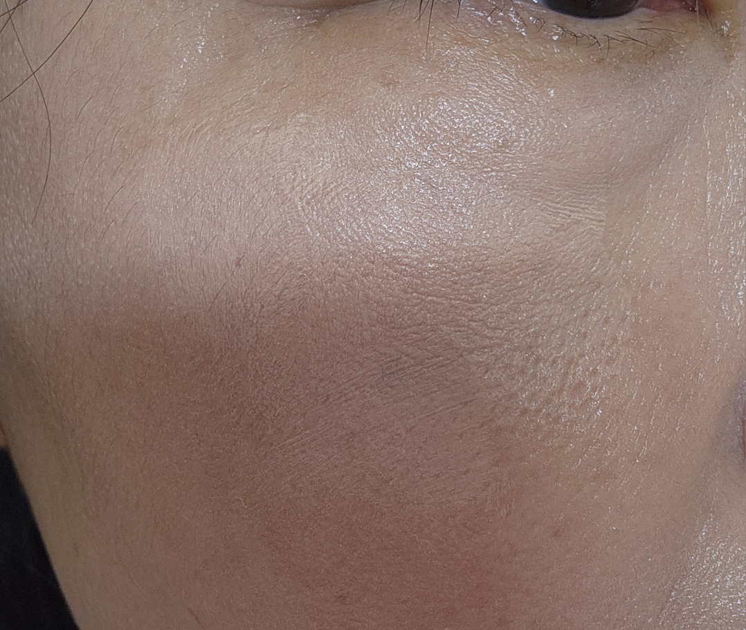 梦幻遮瑕膏的真实用户使用照片