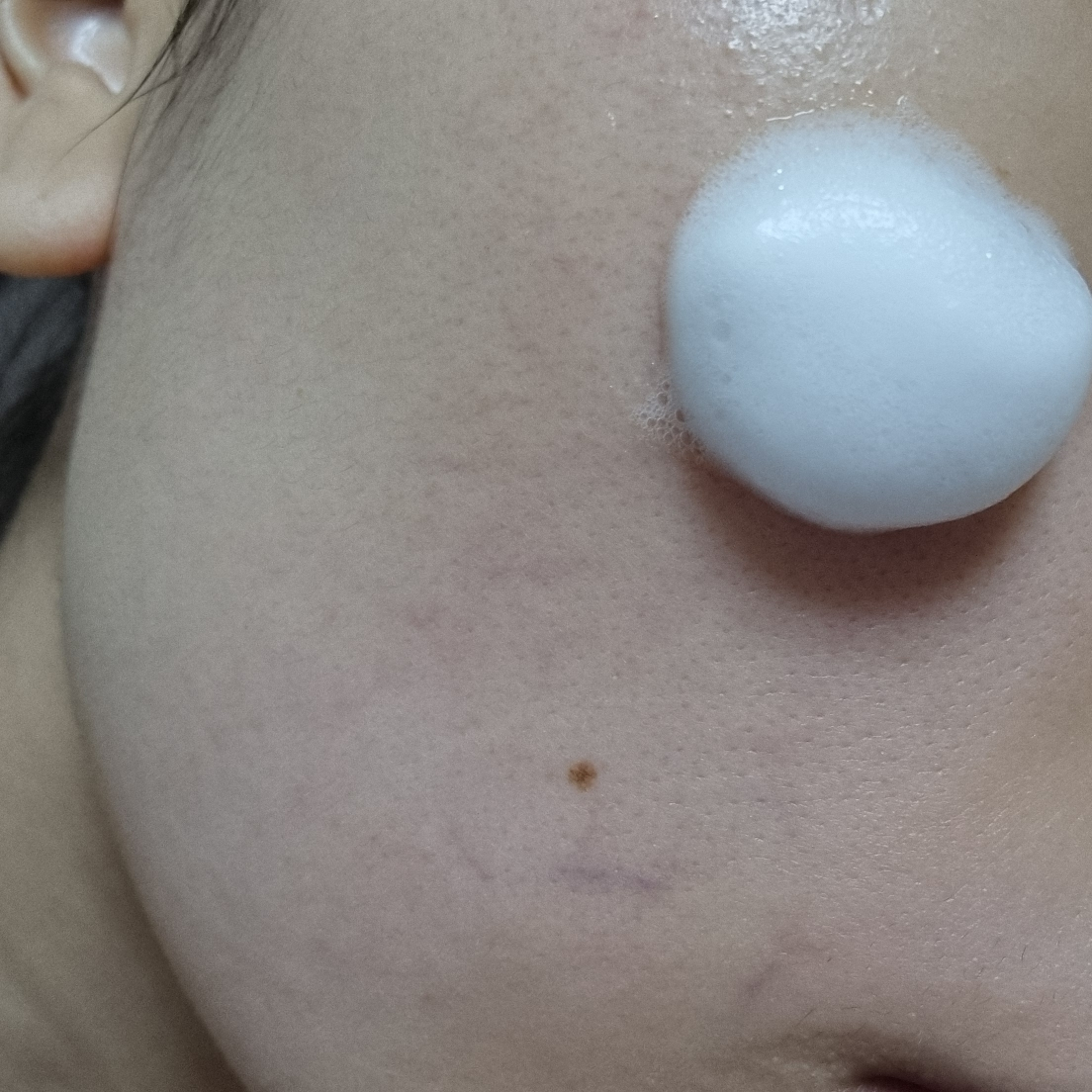 Hyalbae 毛孔泡泡精华液的真实用户使用照片