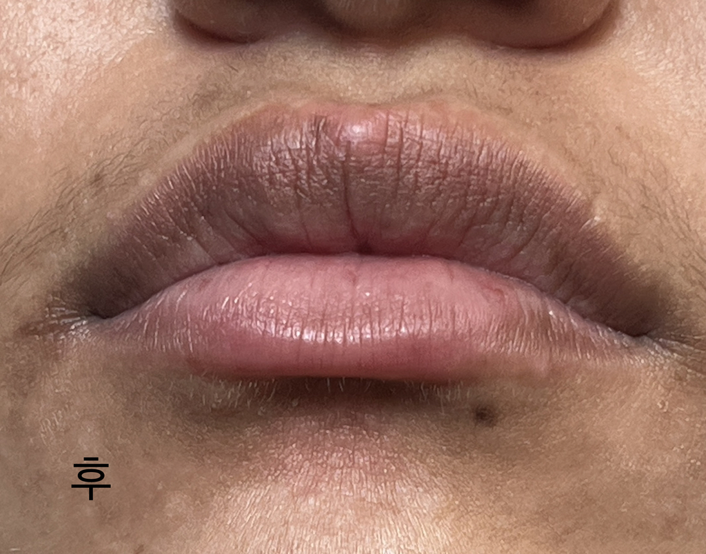 토코보 (TOCOBO) 민트 쿨링 립 마스크 review image