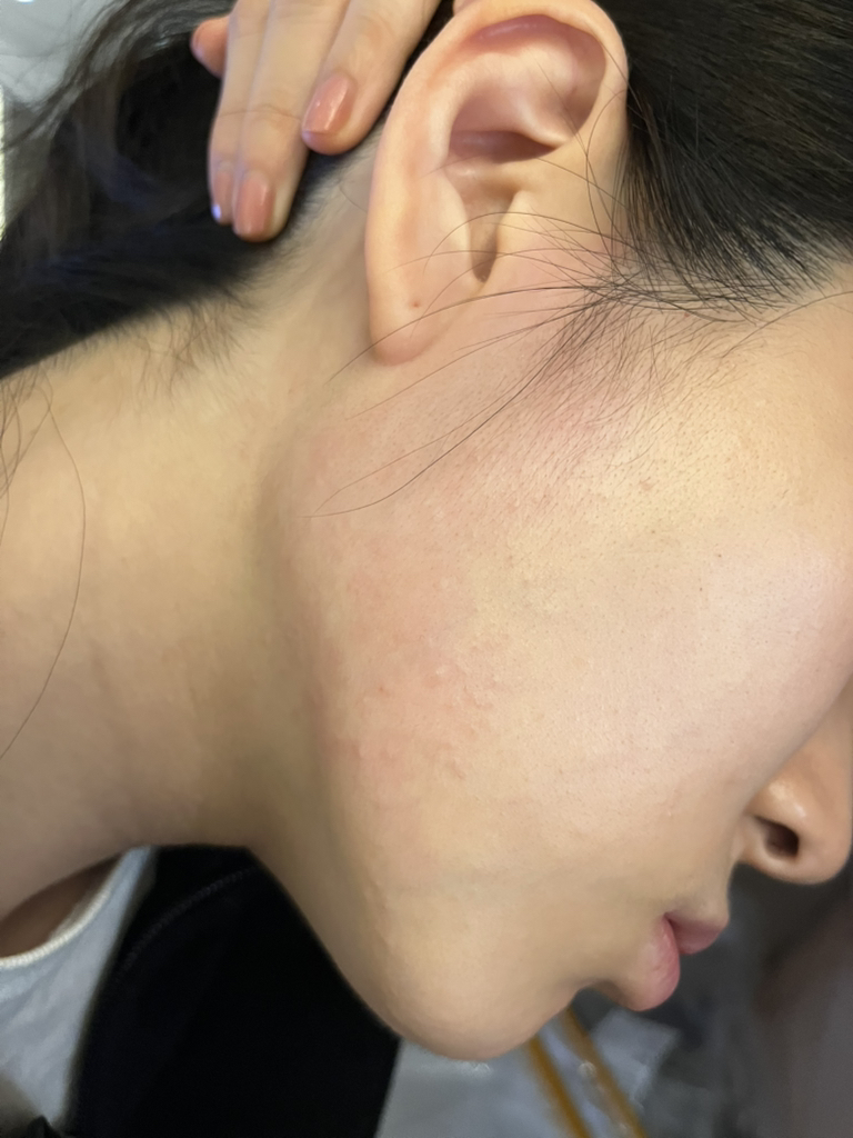 低分子玻尿酸面膜的真实用户使用照片