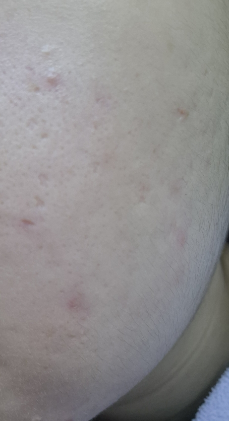 보나메두사 (bonamedusa) 판타지 컨실러 review image