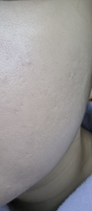 보나메두사 (bonamedusa) 판타지 컨실러 review image