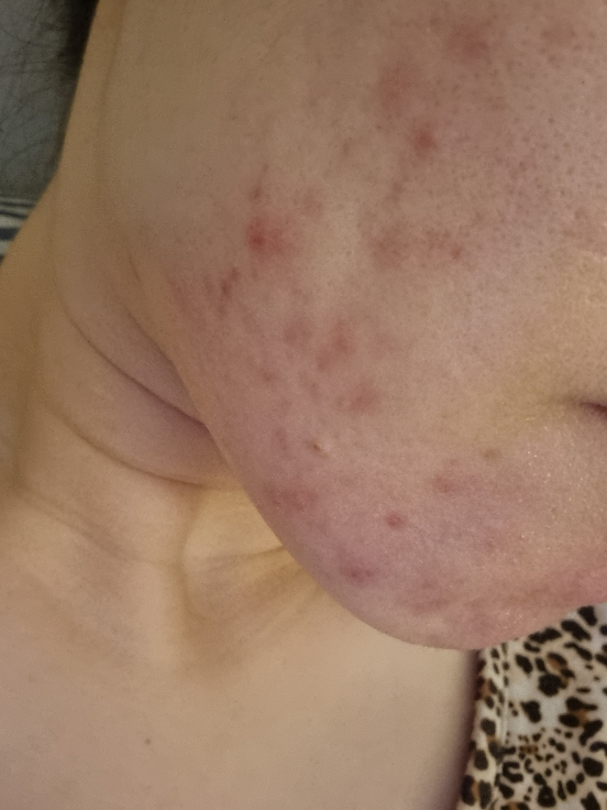 allNATURAL Mặt nạ [Cây ngải cứu] review image