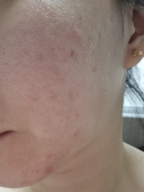 allNATURAL Mặt nạ [Cây ngải cứu] review image