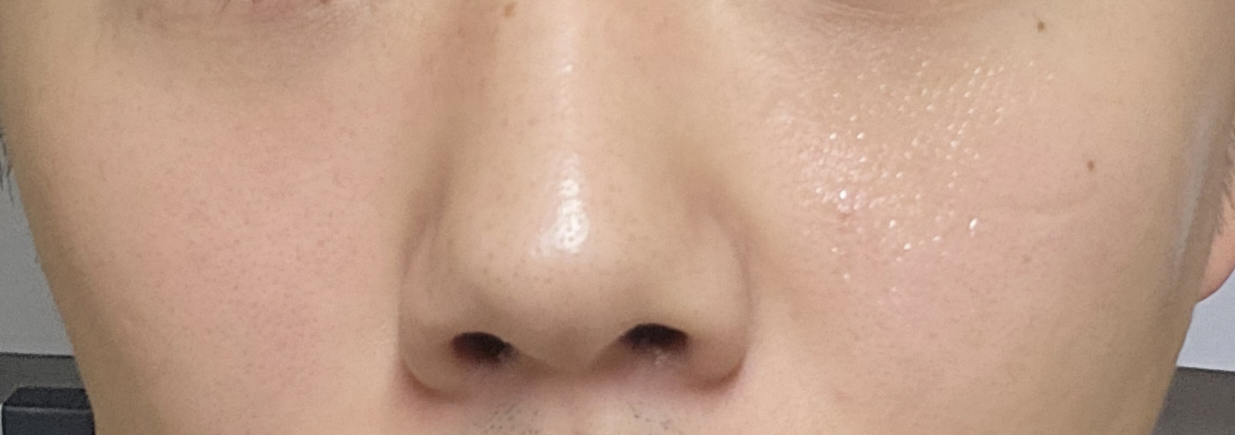 셀누트 (CellNutt) 마이세컨스킨 시카 review image