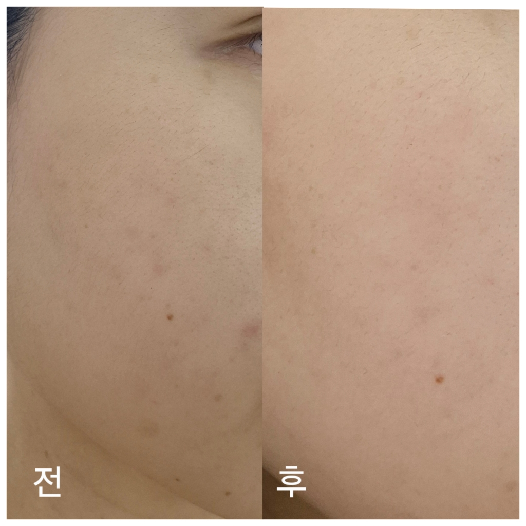 셀누트 (CellNutt) 마이세컨스킨 시카 review image