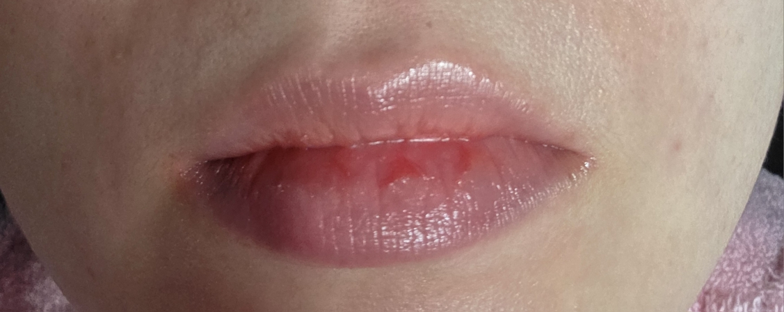 唇部护理 [草莓光泽］的真实用户使用照片