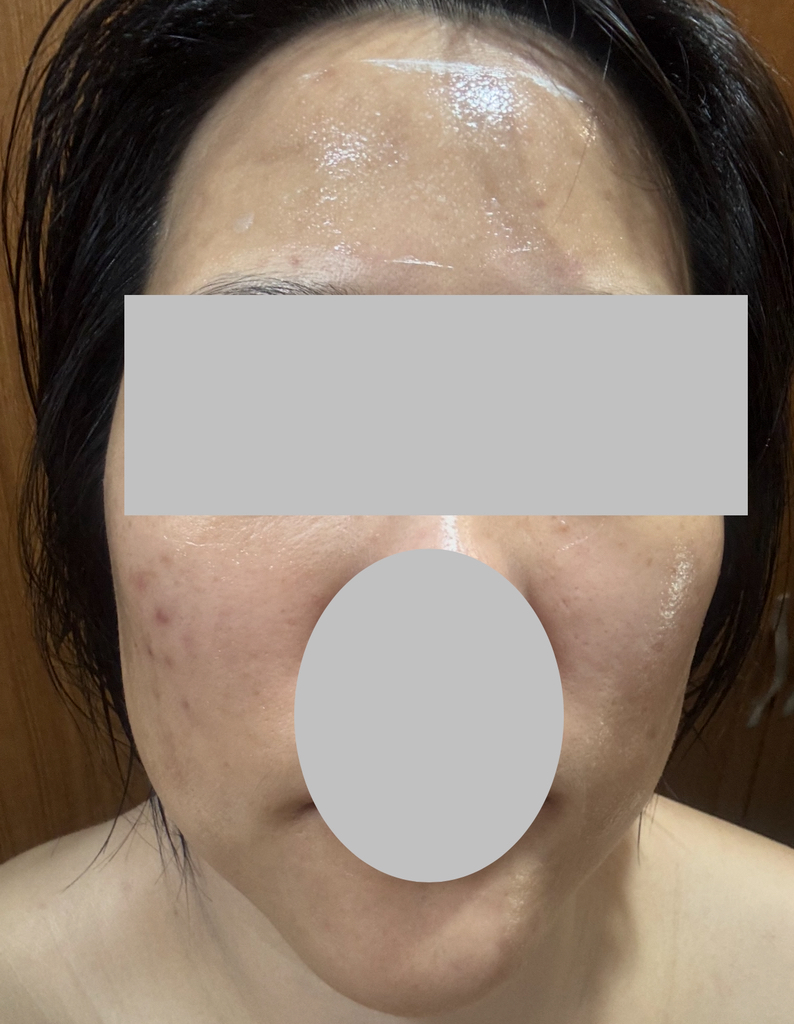 셀누트 (CellNutt) 마이세컨스킨 콜라겐 review image