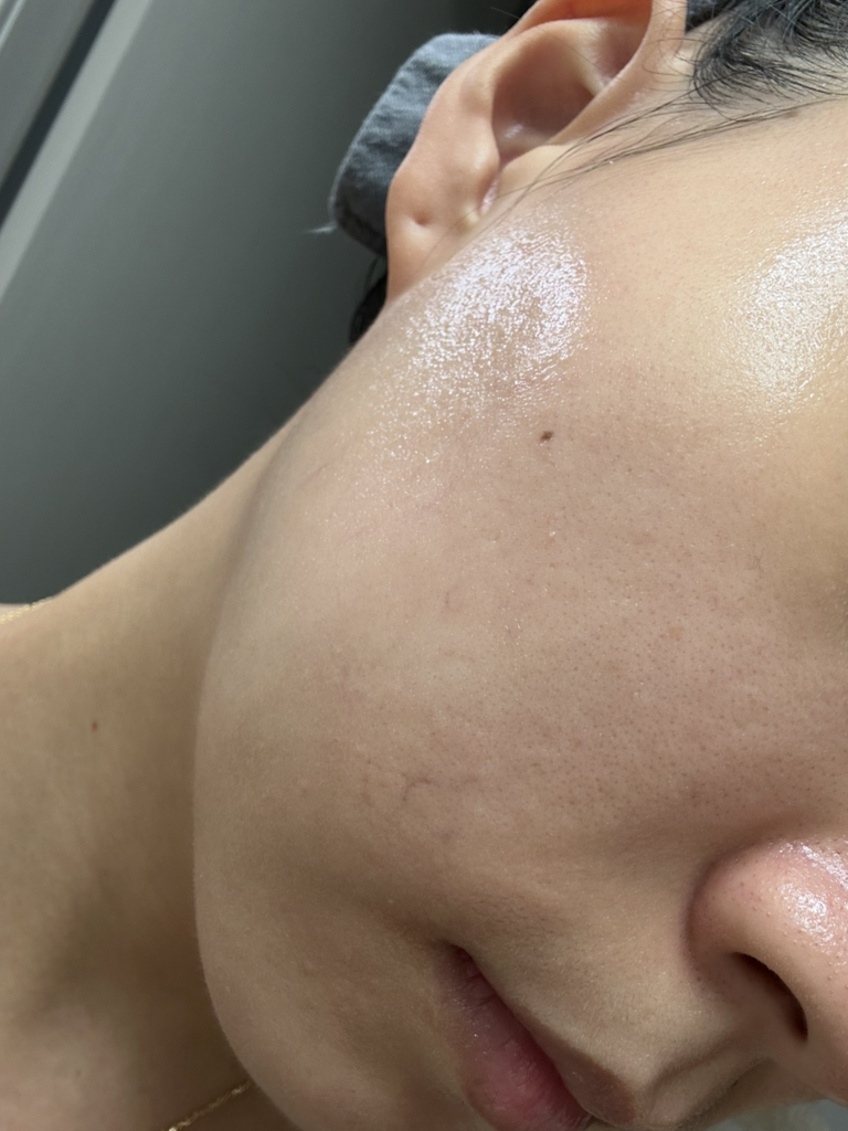 내피부과의사의휴가 (MyDermatologist'sVacation) 마이크로패쓰 꾹탬프 [모공케어] review image