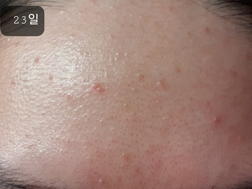 아크웰 (acwell) 리얼 아쿠아 밸런싱 크림 review image