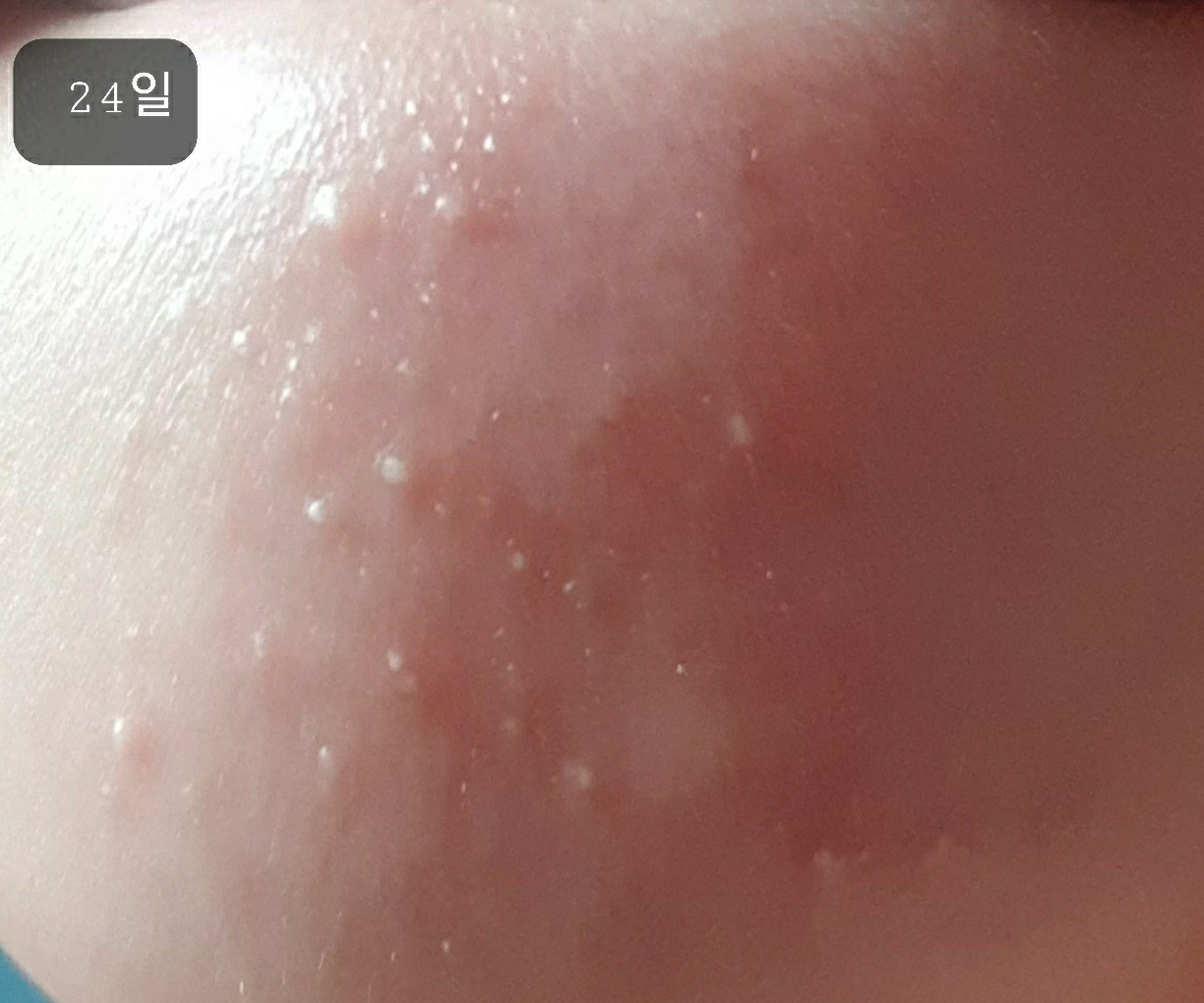 아크웰 (acwell) 리얼 아쿠아 밸런싱 크림 review image