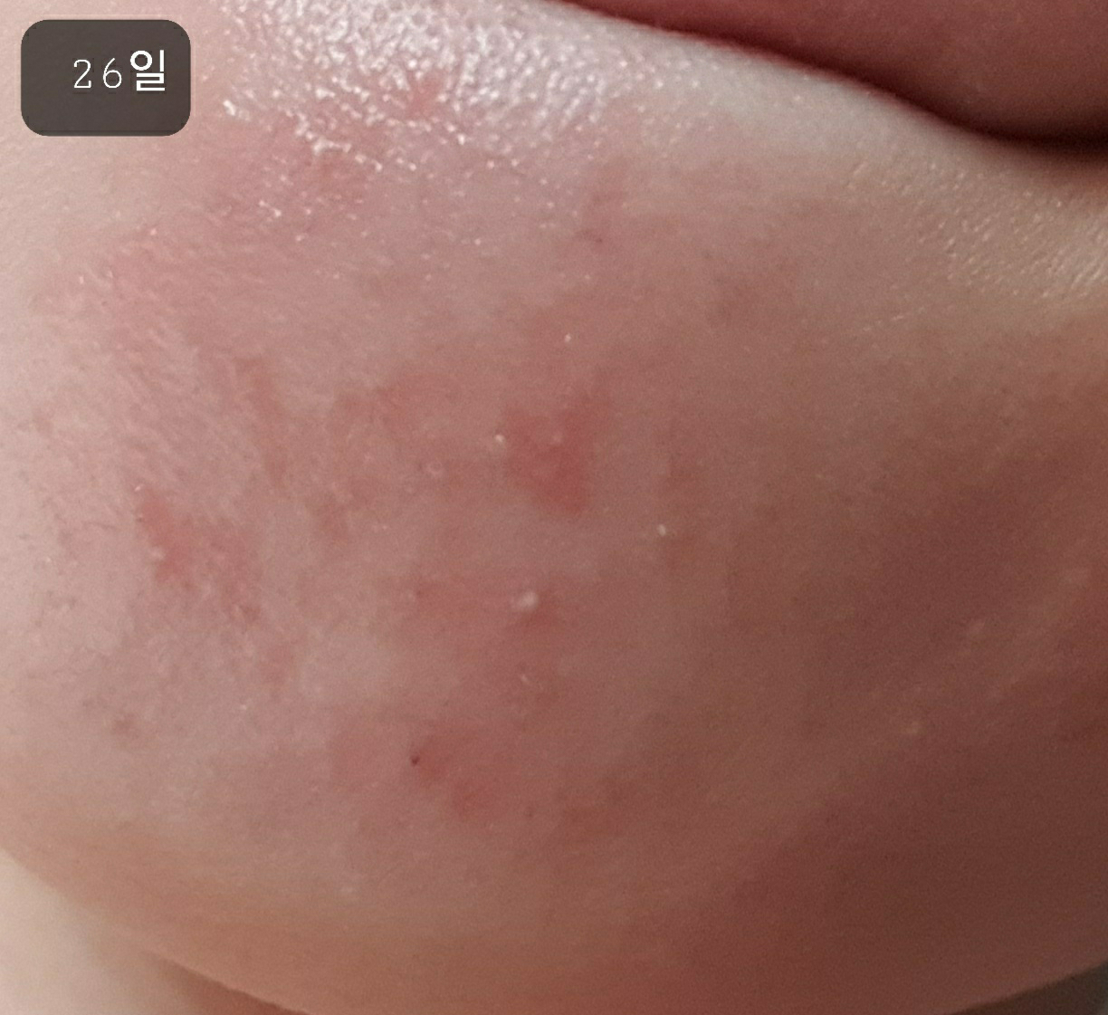 아크웰 (acwell) 리얼 아쿠아 밸런싱 크림 review image