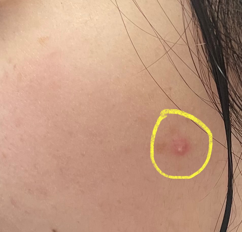 퓨어리카 (purelica) 슬로우에이징 시카 토너 review image