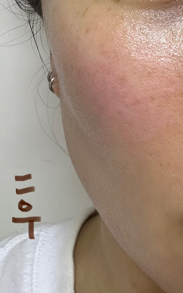 퓨어리카 (purelica) 슬로우에이징 시카 토너 review image