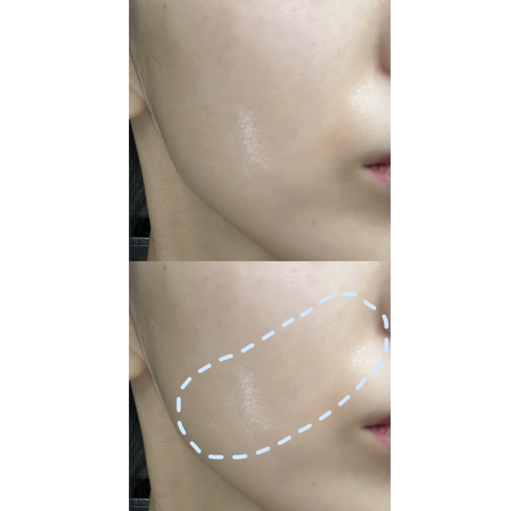 셀누트 (CellNutt) 마이세컨스킨 콜라겐 review image