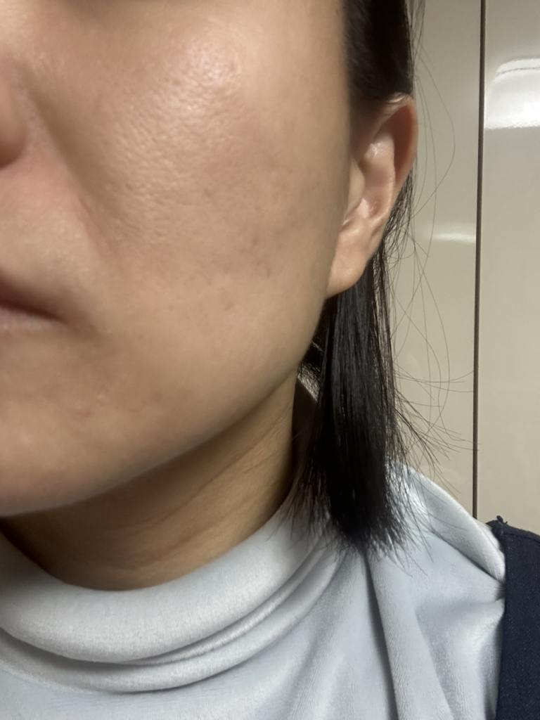 퓨어리카 (purelica) 슬로우에이징 H.A. 크림 review image