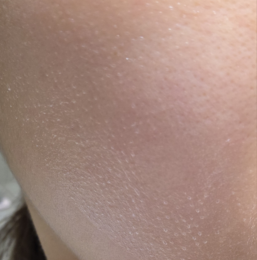 셀누트 (CellNutt) 마이세컨스킨 시카 review image