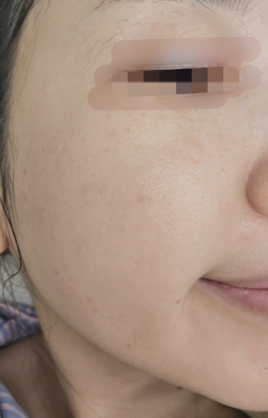 바노바기 (BANOBAGI) 비타 제닉 젤리 마스크 [시카] review image