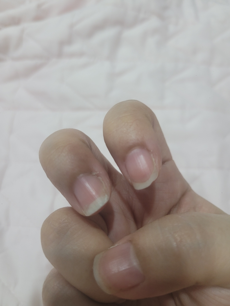 아워덤 (OURDERM) 타임리스뷰티 네일솔루션 review image