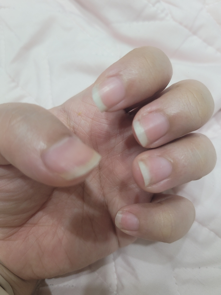 아워덤 (OURDERM) 타임리스뷰티 네일솔루션 review image