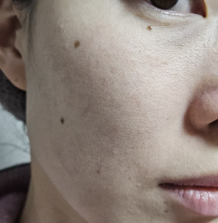 바노바기 (BANOBAGI) 비타 제닉 젤리 마스크 [시카] review image