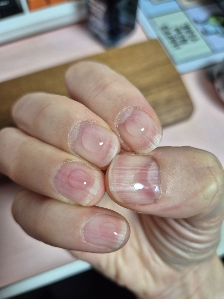 아워덤 (OURDERM) 타임리스뷰티 네일솔루션 review image