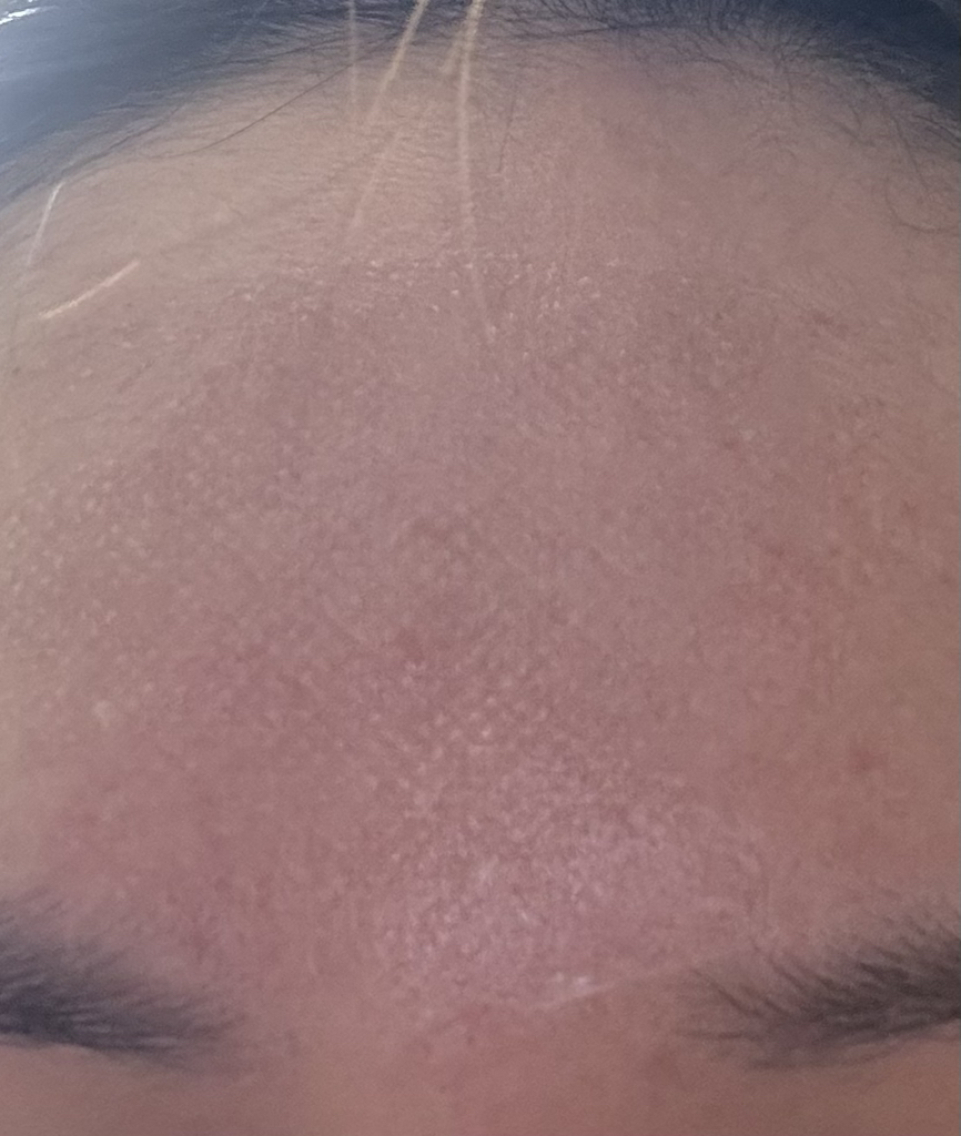 셀누트 (CellNutt) 마이세컨스킨 시카 review image