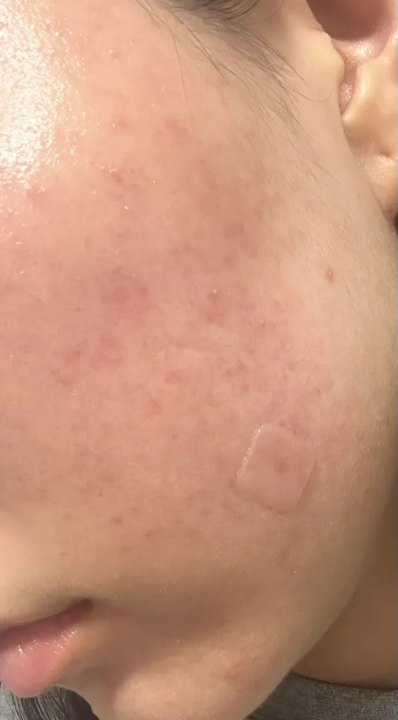 hidiff Tónico de burbujas Royal Layering review image