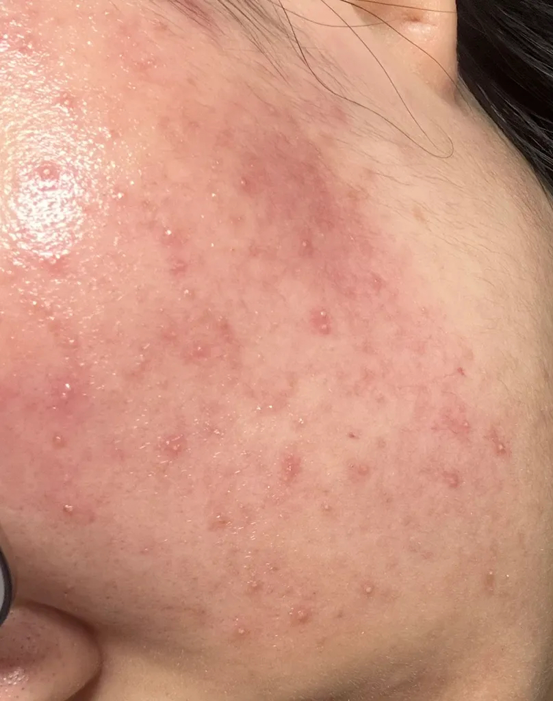 hidiff Tónico de burbujas Royal Layering review image