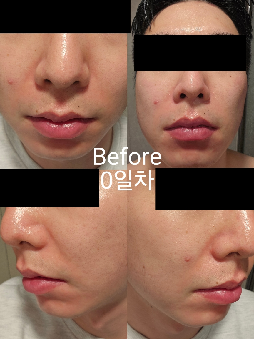 미닉 (MINIC) 퍼펙트 콜라드 그린 진정 크림 review image