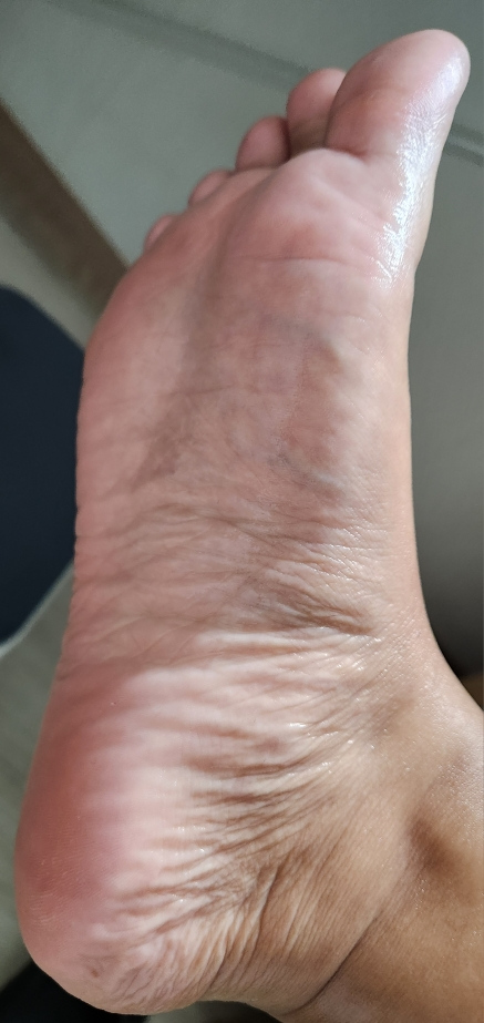 이니스프리 (INNISFREE) 스페셜 케어 마스크 [풋] review image