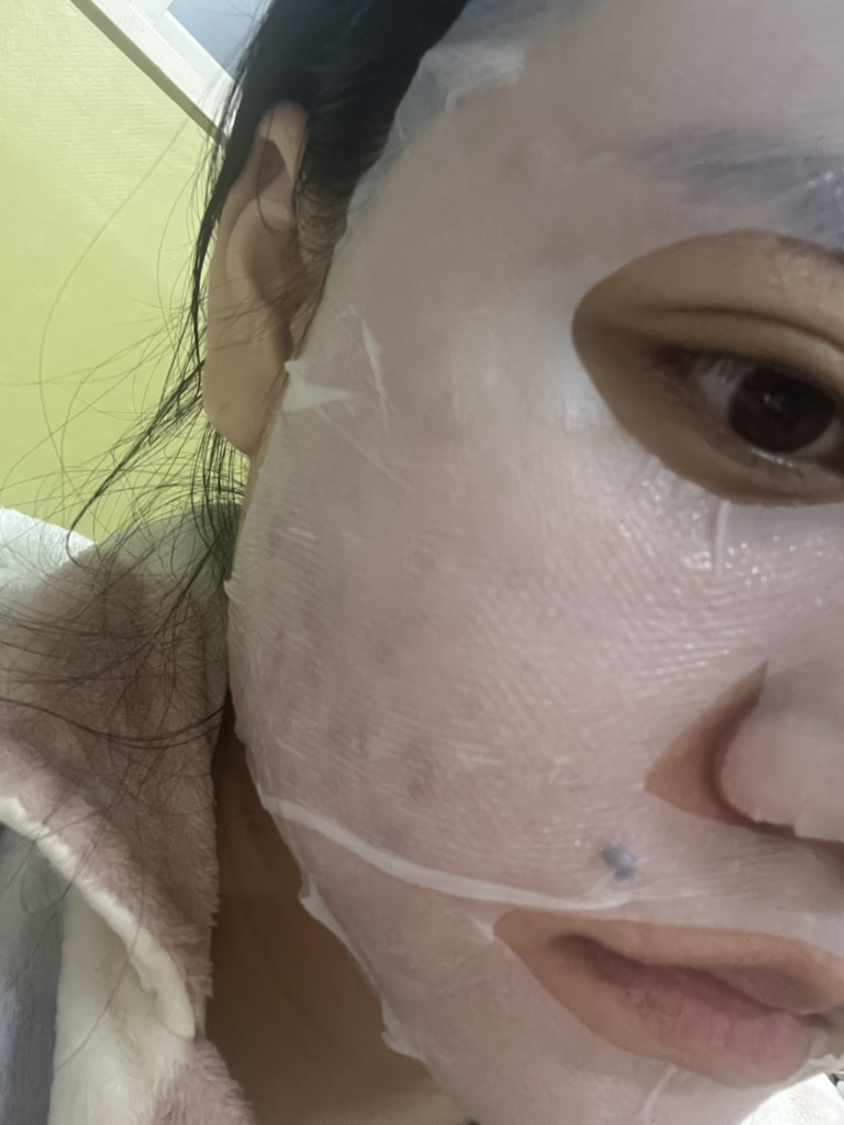 이옴 (EIoM) 트러블 패치 마스크 review image